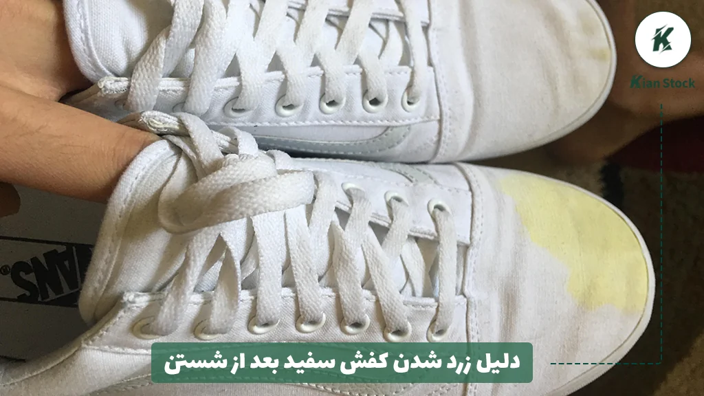 دلیل زرد شدن کفش سفید بعد از شستن